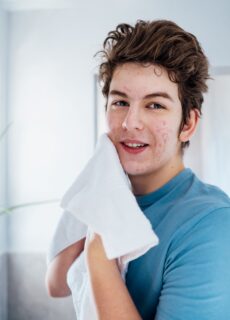 Czego nie robić z pryszczem? 5 najgorszych nawyków pielęgnacyjnych