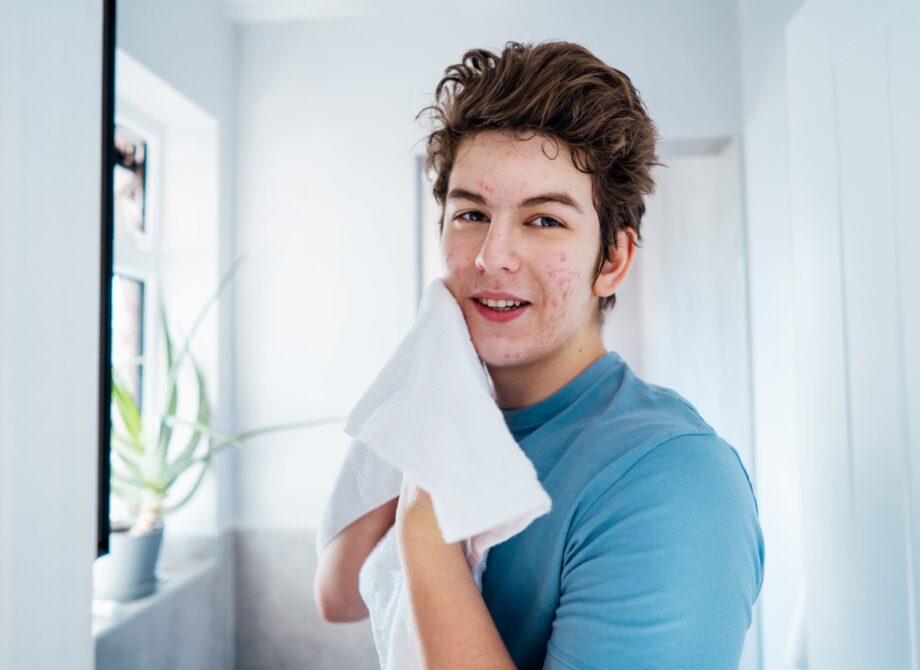 Czego nie robić z pryszczem? 5 najgorszych nawyków pielęgnacyjnych
